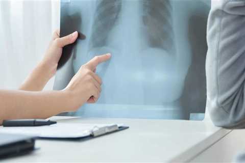 How long does it take for asbestos to affect your lungs?