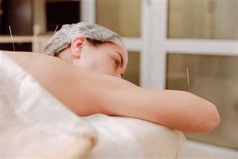 HOW TO USE ACUPUNCTURE FOR WHIPLASH PAIN RELIEF